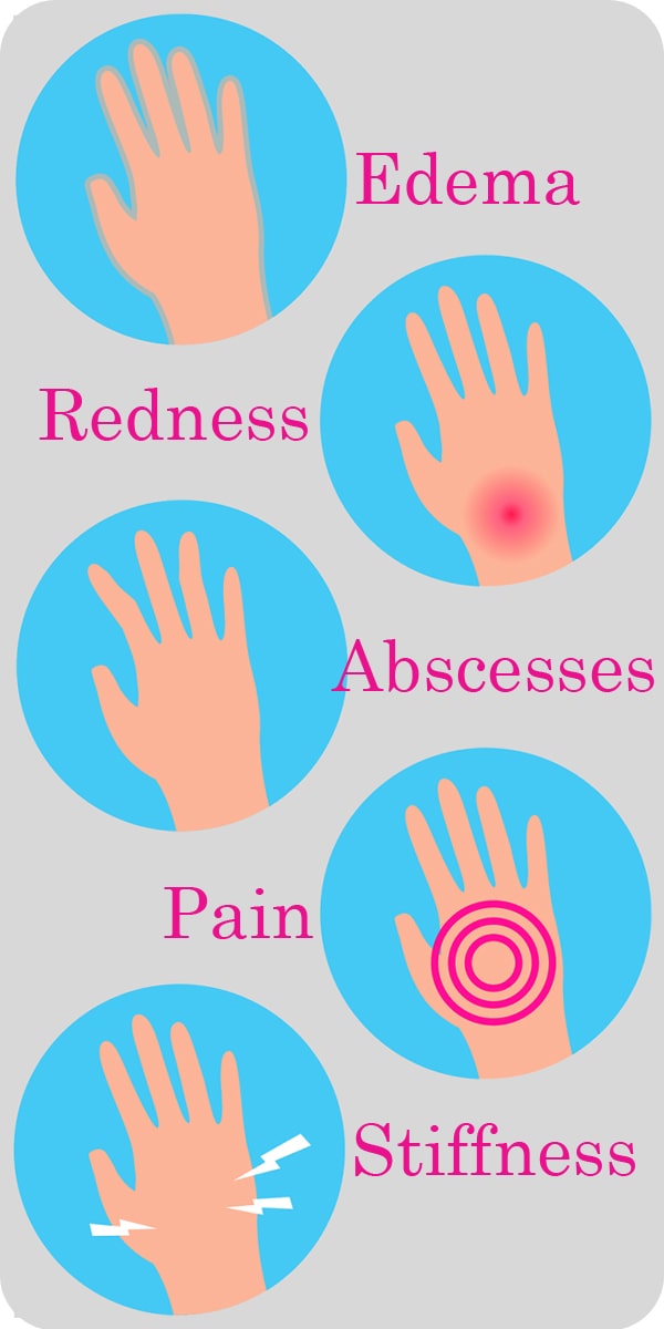 What does Arthritis Feel Like-What does Arthritis Look Like-Explained In Graphics-Pain-Redness-Edema-Stiffness-Abcesses-min