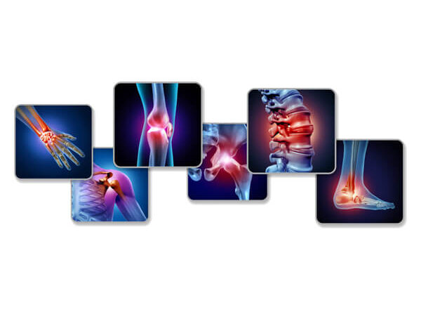 Arthiritis Blog