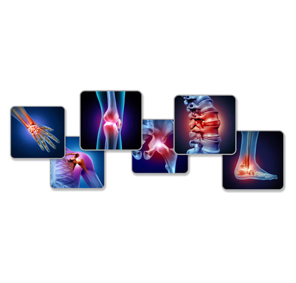 Arthiritis Blog